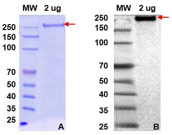 桿狀病毒-昆蟲細胞蛋白表達服務(wù)