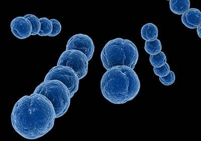 真核表達系統(tǒng)和原核表達系統(tǒng)的優(yōu)缺點各有哪些?