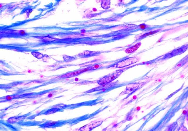 面對蛋白包涵體，我們只能束手無策？