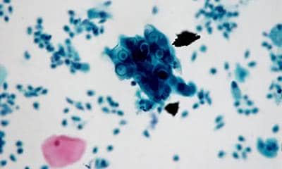 盤點多克隆抗體的優點和缺點