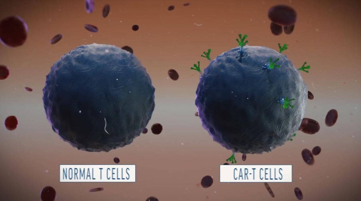 解讀：功能失調(diào)的CAR-T細(xì)胞的特征