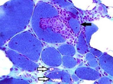 熒光抗體技術知多少
