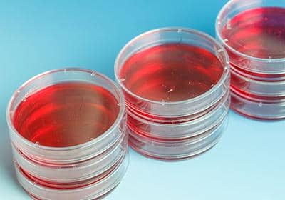 盤點雜交瘤細胞技術制備單克隆抗體會遇到的問題