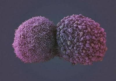 雜交瘤技術制備抗體的相關原理和詳細步驟