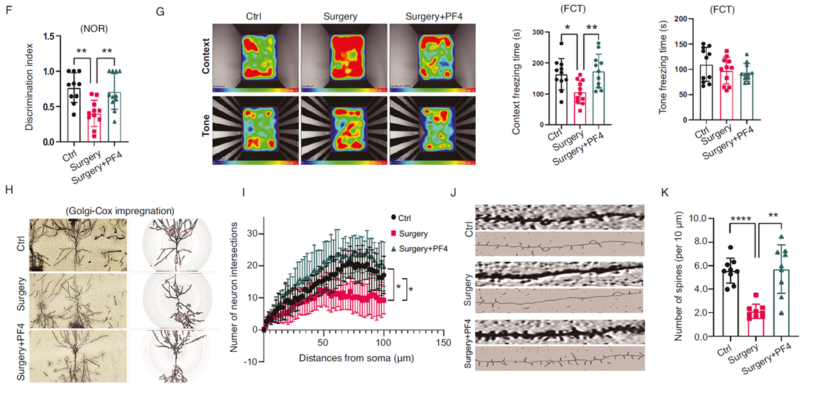 PF4可改善并修復(fù)認知功能