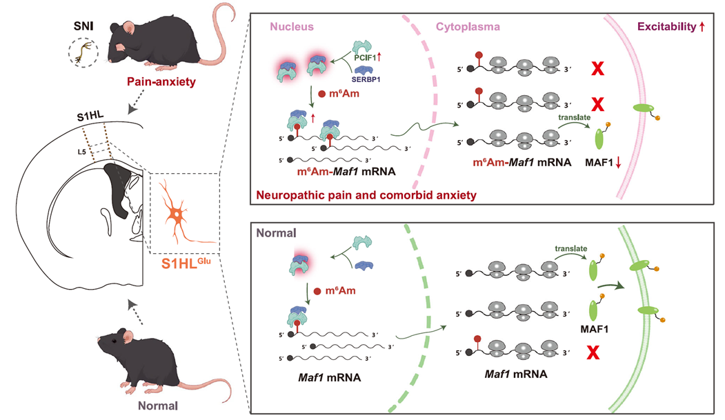 S1HLGlu神經(jīng)元中的SERBP1-PCIF1復(fù)合體如何參與神經(jīng)性疼痛和并發(fā)焦慮的發(fā)育與維持