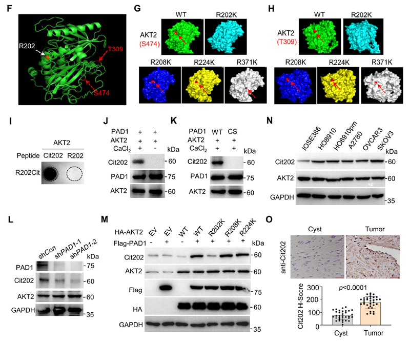  PAD1在R202位點對AKT2的瓜氨酸化促進(jìn)OC細(xì)胞中AKT2酶活性
