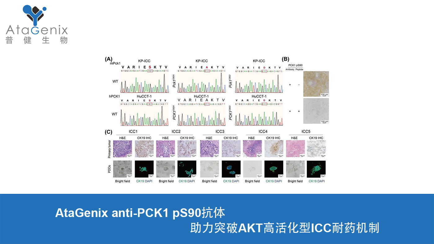 AtaGenix anti-PCK1 pS90抗體助力突破AKT高活化型ICC耐藥機(jī)制
